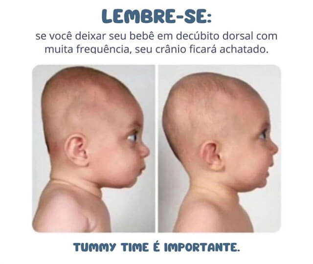 Tummy Time: entenda por que esta prática é importante para o seu bebê